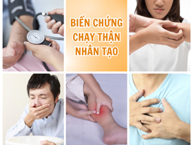 Top 5+ biến chứng chạy thận nhân tạo bạn cần biết